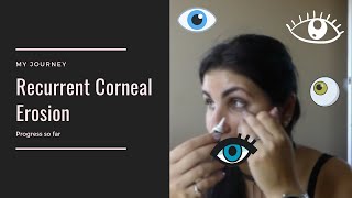 My Journey With Recurrent Corneal Erosion [upl. by Georgianne692]