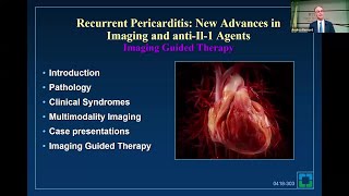 Recurrent Pericarditis New Advances in Imaging and AntiIL1 Agents [upl. by Sisco]