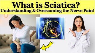 What is Sciatica Understanding and Overcoming the Nerve Pain [upl. by Amathiste]