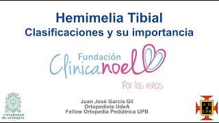 Hemimelia Tibial  Clasificación y su importancia [upl. by Lerad]