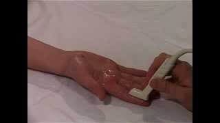 Musculoskeletal Ultrasound Hand 7 palmar longitudinal scan of DIP joint [upl. by Adnawot]