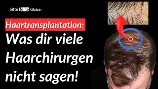 Empfängerbereich Haartransplantation Basic Wissen [upl. by Diena86]