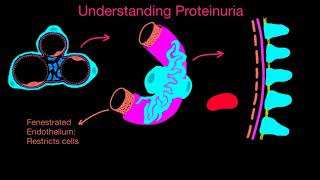 Proteinuria 1 [upl. by Bunnie]