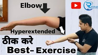 hyperextended elbow treatmentkohni ka tirchapan kaise thik kareelbow deformity elbows elbowpain [upl. by Heron575]