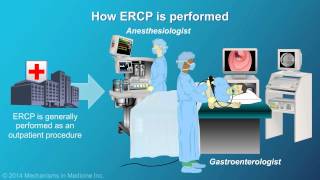 Understanding ERCP Endoscopic Retrograde Cholangiopancreatography [upl. by Gluck412]