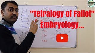 Embryological basis of Tetralogy of Fallot [upl. by Kcirevam]