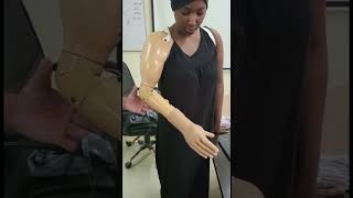 😱 Myoelectric Hand in Delhi  Above Elbow Prosthesis  Nakli Hath  Mechanical Elbow  naklihath [upl. by Bryant500]