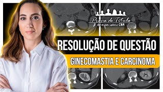 Resolução de QUESTÃO de GINECOMASTIA e CARCINOMA da Prova do CBR [upl. by Josiah355]