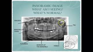 Radiographic Interpretation of Dental Anatomy [upl. by Clougher]