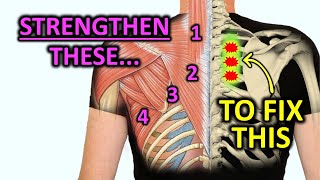 Strengthen These Muscles To Fix Rhomboid Pain [upl. by Armitage]