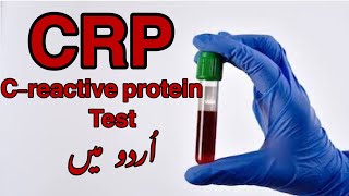 CRP Test In Urdu  What does a high CRP level mean  What does CRP test show What is a normal CRP [upl. by Eedyak]