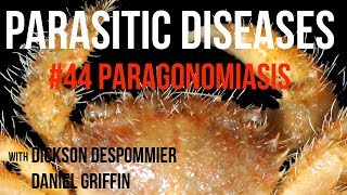 Parasitic Diseases Lectures 44 Paragonomiasis [upl. by Lemhaj]