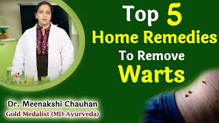 Top 5 Home Remedies To Remove Warts [upl. by Juno]