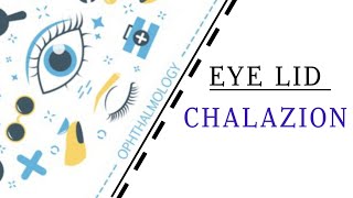 EYELID LECTURE2 CHALAZION [upl. by Eimmat]