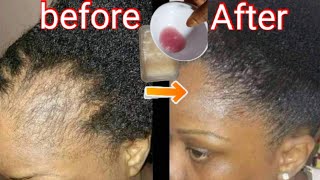 I used Rice Water on my Hair for 2 months After Haircut [upl. by Berni]