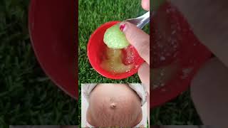 how to remove stretch mark at home best home remedies for stretch marks Priticreation [upl. by Ellezig]