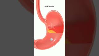 Stomach pain  medical knowledge  trend video  viral short  views [upl. by Dirrej]