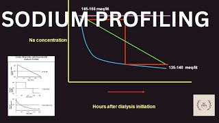 Sodium profiling in hemodialysis Sodium profiling of dialysis Sodium profiling Sodium profile [upl. by Ameehs]