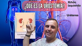 ¿QUÉ ES LA UROSTOMÍA [upl. by Haram]