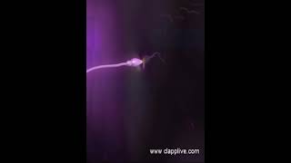 Fertilization process 13 Male sperm pernitrate in to the female ovum 3D Animation [upl. by Ahsataj472]