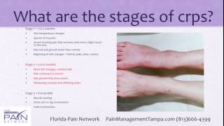 Basics of RSD and CRPS Treatment at Top Tampa Pain Centers 813 6664399 [upl. by Eatnuahs]