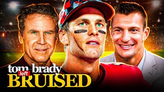 quotOOOUCH Tom Brady Left Bruised and Battered [upl. by Katharyn]