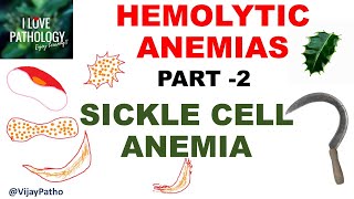 Hemolytic Anemias Part 2 SICKLE CELL ANEMIA Pathology [upl. by Havener33]