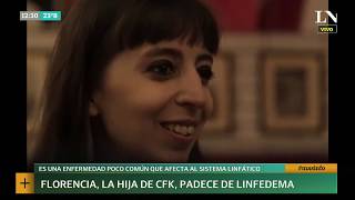 Linfedema ¿qué es la enfermedad que padece Florencia Kirchner  INFO por LN [upl. by Aube]