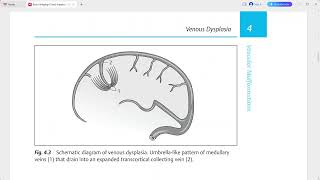 BRAIN DIRECT DIAGNOSIS [upl. by Latoya]