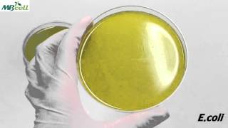 Bacillus Cereus Agar [upl. by Ydnat290]