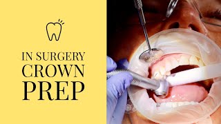 In the surgery tooth crown preparation [upl. by Veradis805]