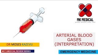 Arterial blood gases  ABGs [upl. by Nitsua]