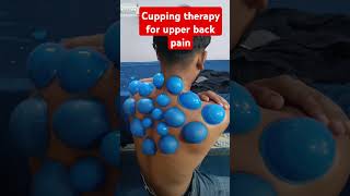 Cupping therapy for upper back amp scapula pain cupping physiotherapy drmanishaphysio love shorts [upl. by Rosinski]