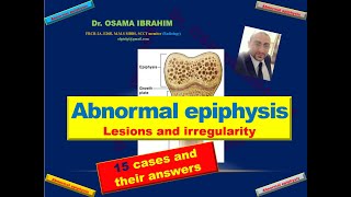 Abnormal epiphysis 15 cases with their answers [upl. by Fawcett]