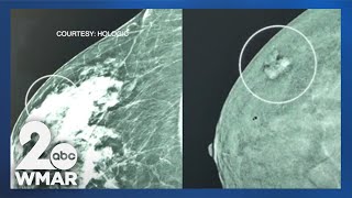 New imaging system breaks down screening barriers for breast cancer detection [upl. by Nylinej]