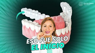 Retenedores dentales Esenciales para tu resultado de ortodoncia [upl. by Atiuqcir747]