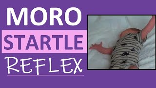 Moro Reflex Newborn Test  Startle Reflex  Pediatric Nursing Assessment [upl. by Leira]