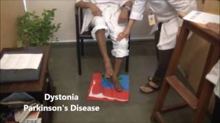 Understanding Dystonia Symptoms in Parkinsons Disease  Dr Paresh Doshi [upl. by Ennovart]