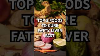 Top 5 Foods to Cure Fatty Liver  NAFLD vs Alcoholic Fatty Liver Disease [upl. by Bay]