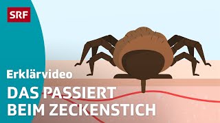 Zeckenstich amp übertragbare Krankheiten – einfach erklärt  Kindervideos  SRF Kids [upl. by Bernat]