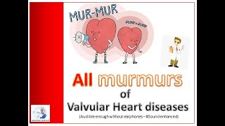 Murmurs of Valvular Heart Diseases Sound enhanced [upl. by Gruchot101]