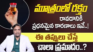 మూత్రంలో రక్తం  Symptoms and Causes of Blood in Urine Telugu  dr Ravi Teja  MhathiHealth [upl. by Tadd]