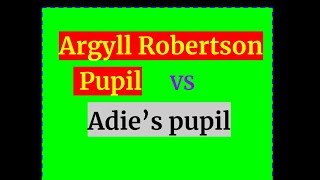 Argyll Robertson pupil VS Adie’s tonic pupil [upl. by Yul]