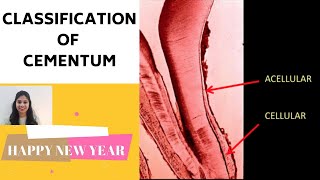 CEMENTUM  PART II II Classification of Cementum [upl. by Muriah]