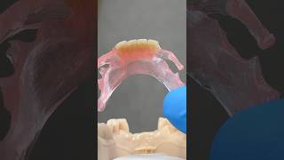 TCS FiberFlex Partial tcsdentalinc tcsdentalinc dental teeth smile lsk121shorts shortvideo [upl. by Anileuqcaj]