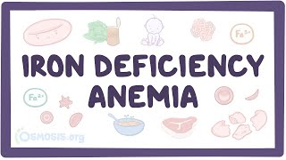 Iron deficiency anemia  an Osmosis Preview [upl. by Atrim]