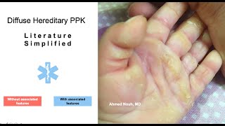 A Clinical approach to Palmoplantar Keratoderma [upl. by Nednerb638]