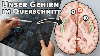 Das Gehirn im Querschnitt alle wichtigen Strukturen [upl. by Yrro]