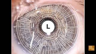 LIVE IRIDOLOGY READING  A Road Map for Healing [upl. by Dimitry]