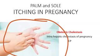 Obstetrics Cholestasis Pregnancy IntraHepatic Liver ICP Itching Palm pregnant Bile Acid Ursodiol [upl. by Nagap570]